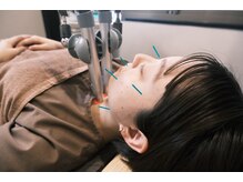 はりきゅう院 さくら/美容鍼