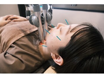 はりきゅう院 さくら/美容鍼