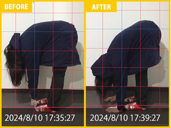 整体院 元 宇城松橋店/頭痛の悩み