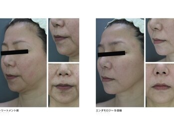 ミロク 伏見桃山店(miroku)/エンダフェイシャル