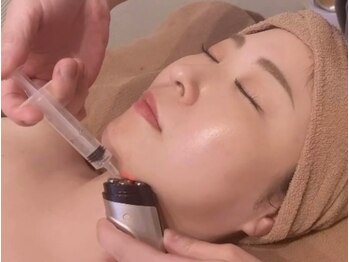 アリュール(ALLURE)の写真/最先端脂肪分解促進【レモンボトル】落ちにくい顔のお肉や顎下の脂肪に◎リバウンドしにくく痛みも少ない◎
