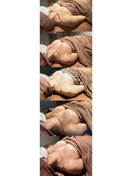 ロココ 豊田店(Rococo)/ビフォーアフター