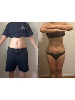 くびれを手に入れたい