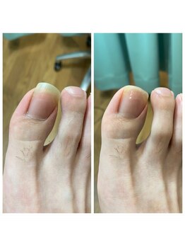 足のトラブルセンター 狸小路店/男性のお客様も大歓迎です