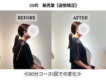 240鍼灸マッサージ院 麻布十番/１回の施術　ビフォーアフター