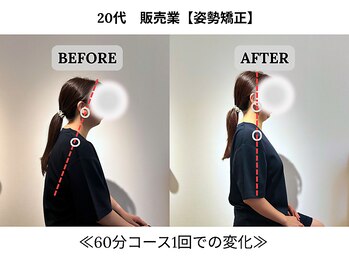 240鍼灸マッサージ院 麻布十番/１回の施術　ビフォーアフター