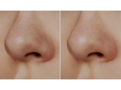 エヴィス(Evisu)の写真