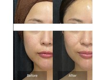 ジュエル シズオカ(JEWEL Shizuoka)