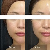 ジュエル シズオカ(JEWEL Shizuoka)