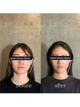コア 中目黒店(Koa)/お客様ビフォーアフター！！