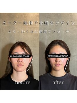 コア 中目黒店(Koa)/お客様ビフォーアフター!!