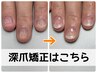 【本気で深爪なおしたい】☆特別価格☆長さを足す深爪矯正。即日見た目改善!