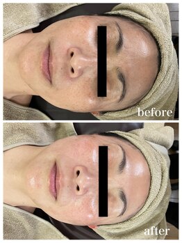 ジャスミン(Jasmin)/エステティック×シェービング