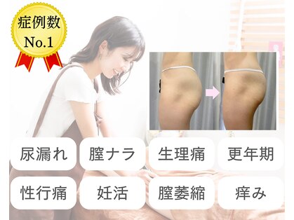 ブーケの写真