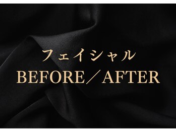 シーフェイス 横浜店(SEE FACE)/小顔/毛穴/オールハンド/美肌