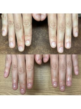 リリ(lili)/自爪育成+クリアジェル