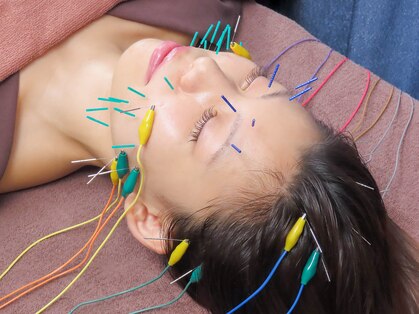 ビハダ(BIHADA)の写真