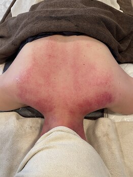 エクセレントビューティーサロン 艶(EN)/究極な辛い肩こり猫背改善