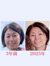 ブロッサム 那覇店/フェイスリリース★効果写真