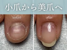 トレフル(Trefle)