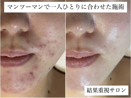 ベルーチェ(Beluce)の写真