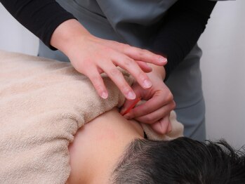 サンライズ鍼灸整骨院 茨木院の写真/【根本改善・予防はサンライズ茨木院で★】腰痛/頭痛/猫背/巻き肩/歪みにも◎お得な限定クーポン有♪