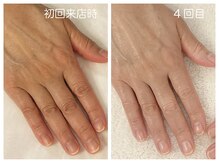 キレイテ 上野店/50代/4回目【ハンドケア稲荷町】