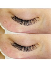 エネル バイ アルト(eneru by arto)/ボリューム120