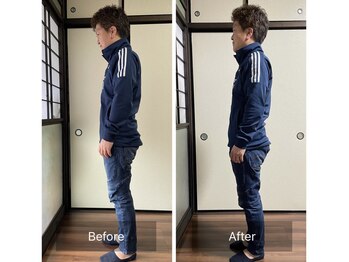 ミントのかべの整体院/姿勢矯正ビフォーアフター