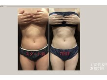 フォルトゥーナ ビューティー(Fortuna Beauty)/