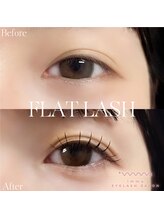 アイマ 北千住(imma)/フラットラッシュ100本