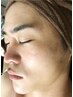 【男性限定】男性資格者によるグリーンピール3Daysアフター無し33000→26400