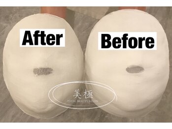 美極 銀座店/銀座/小顔コルギ/小顔矯正