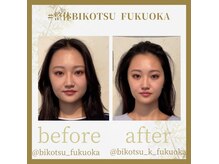 ビコツ フクオカ(BIKOTSU FUKUOKA)の雰囲気（１度でも実感！before &after）