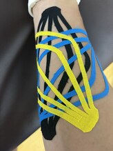 雅 クリニカルルーム/前腕の張り、筋肉痛テーピング
