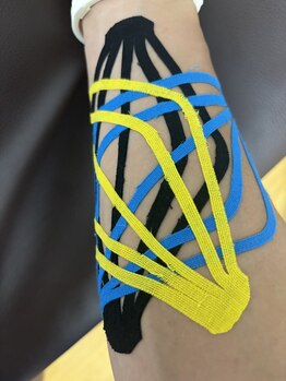 雅 クリニカルルーム/前腕の張り、筋肉痛テーピング