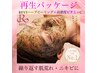 【結果重視◎】繰り返すニキビ・赤み肌にアプローチハーブピーリング¥8800