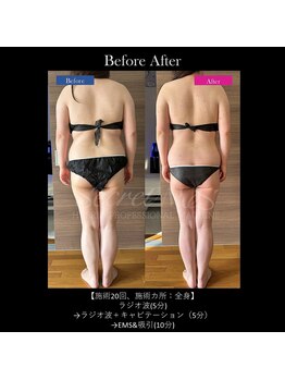 フェレザ 新潟(Felleza)/新潟-痩身エステ-BODYエステ