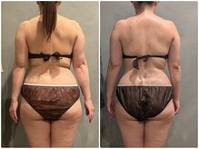 ツーアップ(2up)/デスクワークお尻も小さくなる