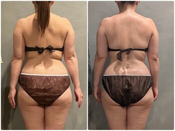 ツーアップ(2up)/デスクワークお尻も小さくなる