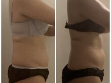 ジェーピーユキノ(jp.yukino)/リラクゼーションで痩身効果あり