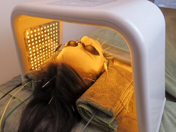 やなけん 亀戸店の写真/あなたの“老け見え”は毛穴の開きやたるみ毛穴かも…結果重視の施術で毛穴を引き締め陶器肌へ導きます♪