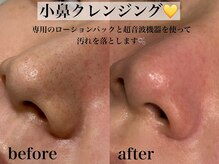 エサージュ 銀座店の雰囲気(今月のおすすめメニュー♪11月限定価格¥3000!!)