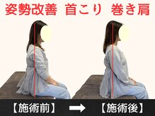 パルマ なかもず(Palma)/整体/頭痛/肩こり/ヘッドスパ