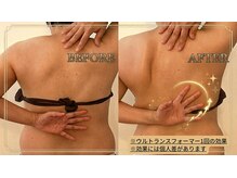 ヒールパーム(Heal Palm)