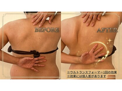 ヒールパーム(Heal Palm)の写真