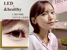 デイズ アイ ベクシー(Day`s eye Becsy)