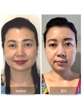 カノン(kanon)の写真/≪キュッと引き締まった小顔へ≫
いくつになってもキレイを更新★優しいチカラで頭蓋骨にアプローチ!!