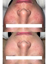 クレアナ ザ ビューティー(KULEANA the beauty)/光フォト