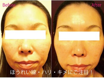 グレースフィオーレ 那覇店(gracefiore)/☆ビフォーアフター１８☆